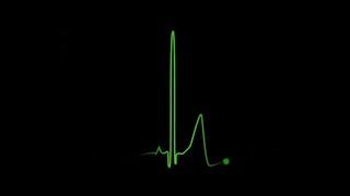 Heartbeat effect |Heartbeat template free |Black screen effect