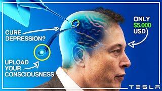 How Neuralink Will Change Humanity..