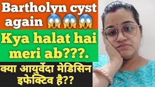 Fir se Bartholin Cyst  kya karu ab ??? Kaise jee paungi is dard ke sath?? in sab sawalo ke jawab