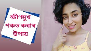 How To Get Chubby Cheeks | Assamese Health Tips