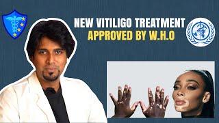 What Is Vitiligo? Symptoms, Causes, Diagnosis, Treatment, and Prevention