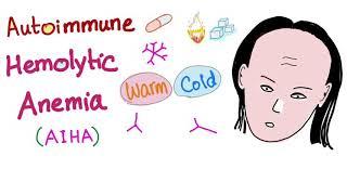 Autoimmune Hemolytic Anemia (AIHA) - Warm autoantibodies (IgG) - Hematology