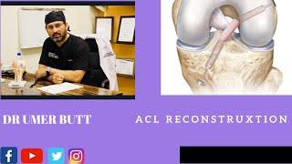 ACL surgery results Dr Umer Butt