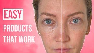 Reduce Dark Under Eye Circles Without Makeup - These Products Will Astonish You!