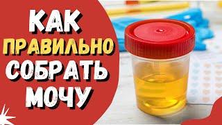 Как правильно собрать мочу для общего анализа #общийанализмочи #анализмочи #оам