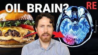 The $212 Billion Dollar Food ingredient poisoning your Brain? RE: What I've Learned