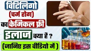 White skin disease treatment | विटिलिगो (चर्म रोग) का केमिकल फ्री इलाज | Safed daag ka ilaaj