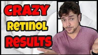 GET RESULTS! Which is Better Retinol, Tretinoin, or Retinaldehyde? | Chris Gibson