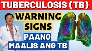 Tuberculosis (TB) Warnings Signs. Paano Maalis ang TB. - By Doc Willie Ong