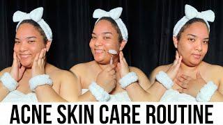 ACNE SKIN CARE  + SHORT HAIR + BLACK HAIR + HOW TO STOP BREAKING OUT + WASH DAY + SELF CARE #Hair