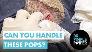 Can You Handle These Pops?