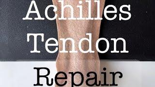 Felt Surgery 🪡 - Open Achilles Tendon Repair