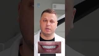 Как новые зубы помогли пациенту пережить covid-19. How new teeth helped a patient survive covid-19.