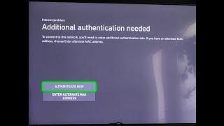 Fixed Additional Authentication Needed Error on Xbox | Internet problem