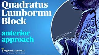 Quadratus lumborum (QL) block: Anterior approach