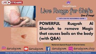 boils and spots on your body caused by Magic, Jinn and Evil Eye Live Ruqyah al Shariah with Q&A