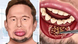 [ASMR] Help Elon Musk treat his swollen lip | WOW Brain Kr Satisfying Video