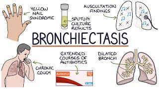 Understanding Bronchiectasis