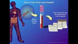 Viral Load and Monitoring