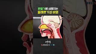 알레르기성 비염과 천식의 관계