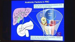 New Hope For PBC Liver Disease