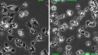 Excitable Signal Transduction Networks in Directed Cell Migration: Supplemental Video 7