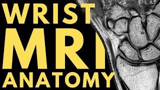 Wrist MRI Anatomy | Radiology anatomy part 1 prep | How to interpret a wrist MRI