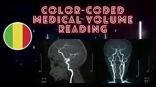 Colour Coded Medical Volume Reading || Project Ideas for Biomedical Engineering Students