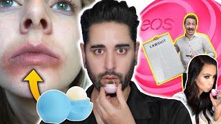 The Lip Balm That DESTROYED Peoples Skin?! The EOS Lip Balm Lawsuit - When Beauty Turns Ugly