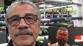 Legendary cutman Stitch Duran gives his thoughts on the treatment of Badou Jack's horrific cut