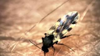 Midge bites through presenters arm - The Secret Life of Midges - BBC