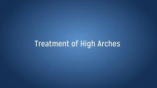Treatment of High Arches