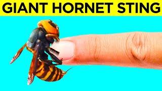 World’s Most Dangerous Insects