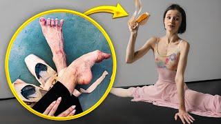 WHAT’S WRONG WITH POINTE SHOES? Ballet Dancer’s Untold Truth…