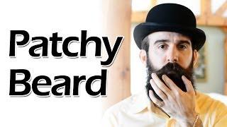 How to Deal with a Patchy Beard