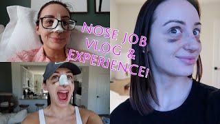 I GOT A NOSE JOB! Septo-Rhinoplasty Vlog & Experience!