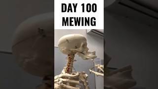 Day 100 mewing
