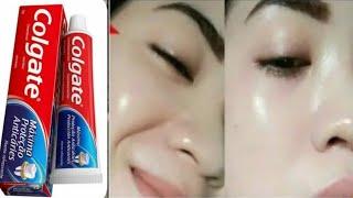 Mask made from ASPIRIN and toothpaste! This skin whitening mask will amaze everyone!