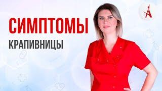 СИМПТОМЫ КРАПИВНИЦЫ