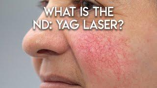 ND: Yag Laser