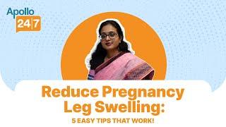 How to Naturally Reduce Leg Swelling During Pregnancy? (5 Home Remedies) | Apollo 24|7