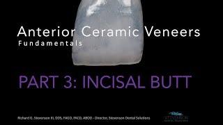 Anterior Ceramic Veneers, Part 3: Incisal Butt Veneer