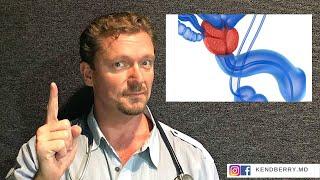 Prostate Health: Your Diet Matters? (BPH-2024)