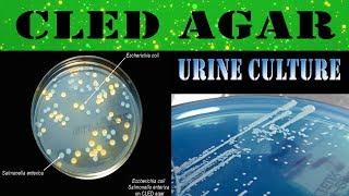 CLED agar media - urine culture/What & Why (clear explanation)