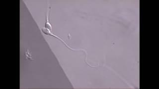 Sperm swimming in microscope field