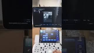 Ultrasounds Minray DC 40/ siêu âm Minray DC 40 test hình ảnh.