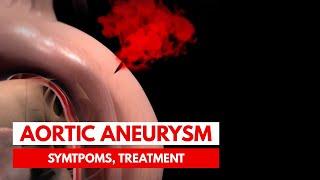 What is an Aortic Aneurysm? | 3D Animation