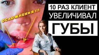 10 раз клиент увеличивал губы - ОСЛОЖНЕНИЯ !!!!