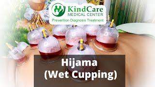 Hijama Procedure |  Wet Cupping therapy benefits | Kindcare Medical Center Dubai