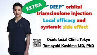 Deep Triamcinolone injection into orbit for thyroid eye disease. Presented in APSOPRS meeting.